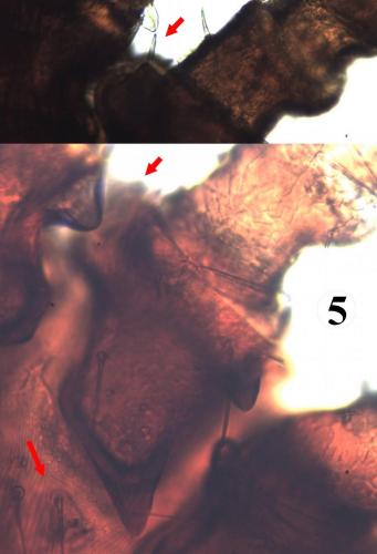 Ixodes festai